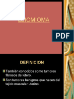 LEIOMIOMA