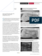 Imaging Intestinal Obstruction