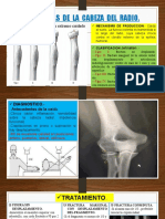 Fracturas de La Cabeza Del Radio