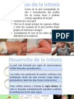 Síntomas y desarrollo de la ictiosis-enfermedad hereditaria