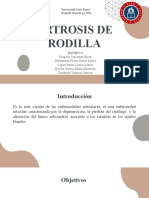 Artrosis de Rodilla