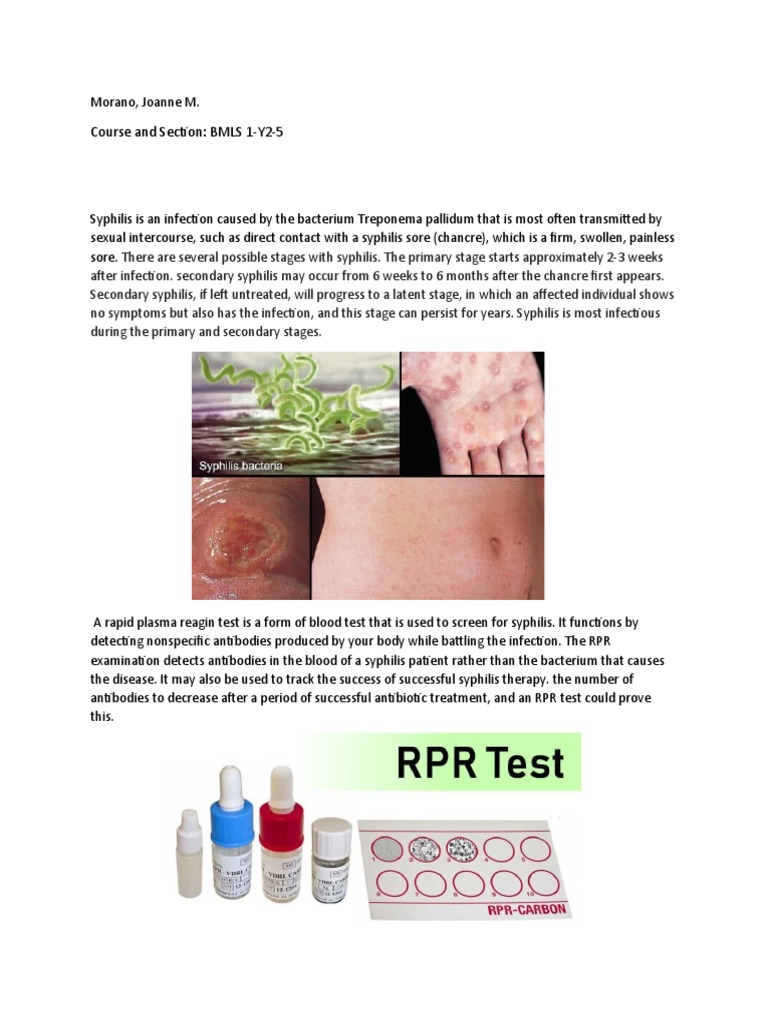 RPR Test and Primary Syphilis Overview | PDF | Infection | Clinical ...