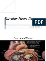 Valvular Heart Disease: Bekele T. (MD)