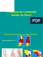 02 - Fract Extr Inf Du Femur