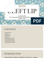 cleft lip-ppt