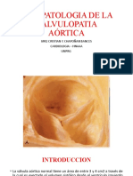 Fisiopatologia de La Valvulopatia Aortica
