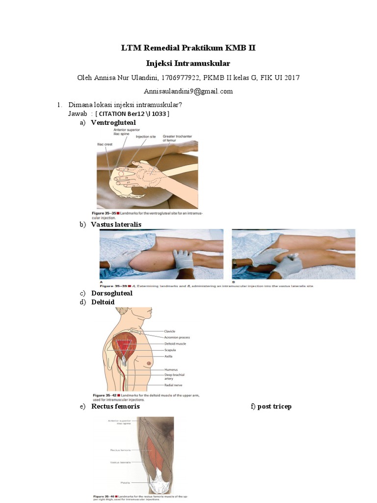Lokasi dan Teknik Injeksi IM | PDF | Sains & Matematika