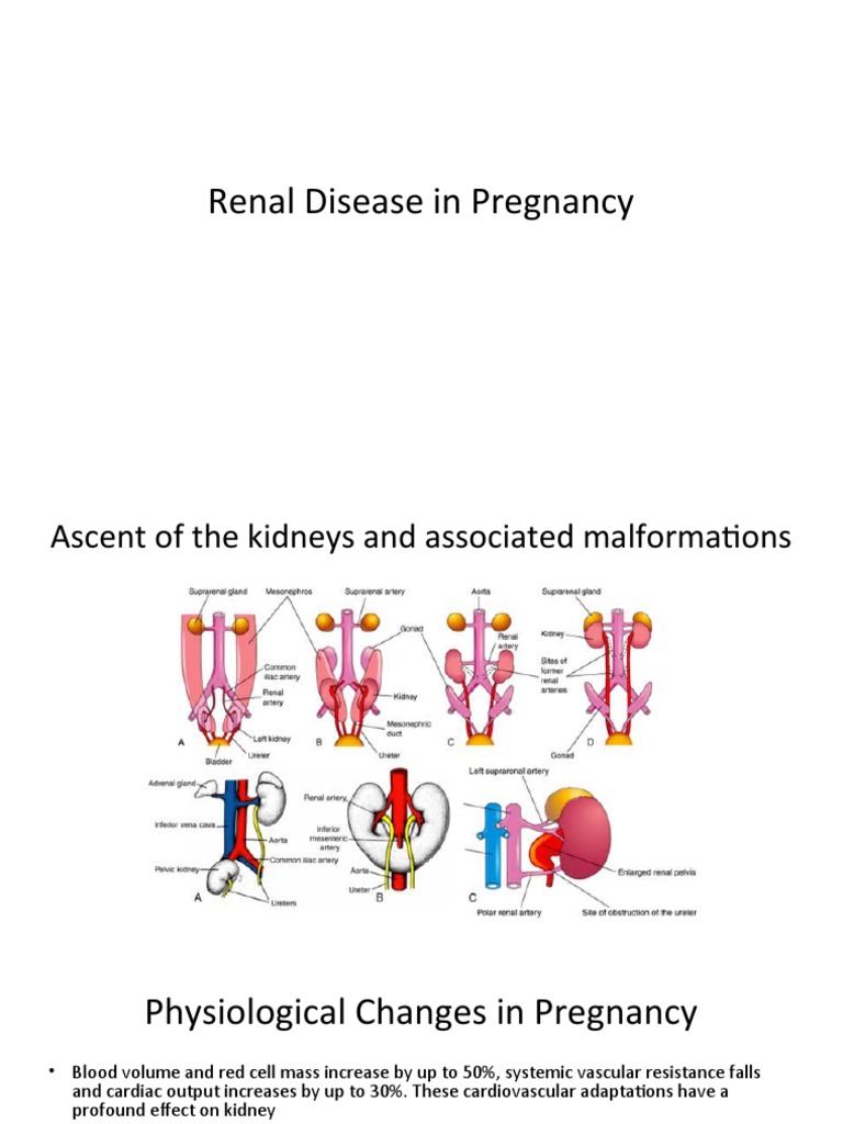 Renal Disease in Pregnancy | PDF | Chronic Kidney Disease | Epidemiology