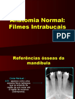 Anatomia Normal de Filmes Intrabucais Parte 6