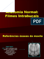 Anatomia Normal de Filmes Intrabucais Parte 3