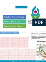 Bloqueo de Rama Derecha