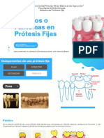 Pónticos en Prótesis Fijas: Clasificación, Requisitos y Casos Clínicos