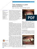 Prosthodontic rehabilitation of a patient with aggressive periodontitis