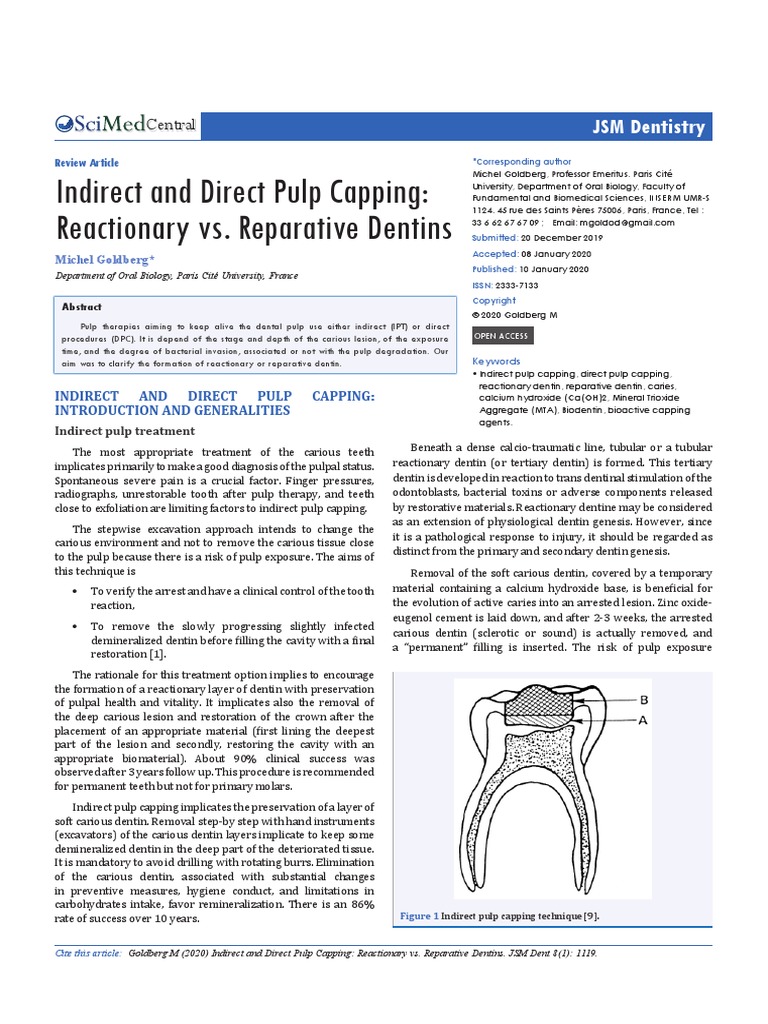Indirect and Direct Pulp Capping Reactionary vs. Reparative Dentins