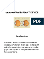 Glaukoma Implant Device