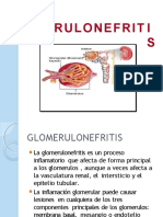 Semana 2 Glomerulonefritis