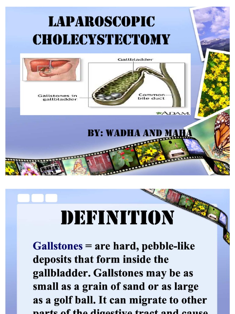 Laparoscopic Cholecystectomy Overview | PDF | Gallbladder | Surgery
