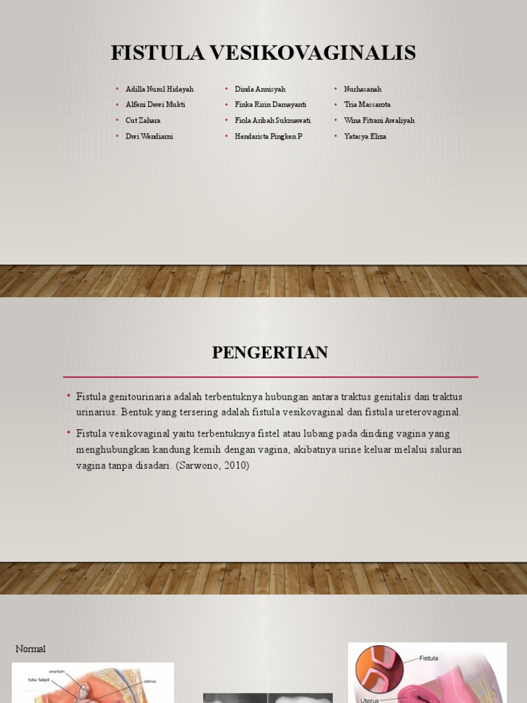 Fistula Vesikovaginalis 4c PDF