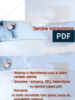 Sarcina extrauterina