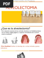Clasificación de Seibert Los Defectos Del Reborde Alveolar | PDF