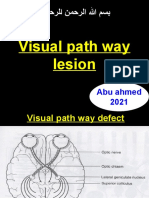 Visual Pathway Lesions and Defects