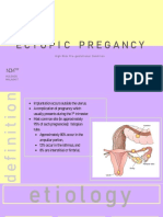 HulgadoMalagkit Maternal Complication Ectopic Pregnancy