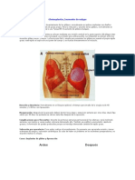 Gluteoplastia