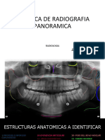 Practica de Radiografia Panoramica