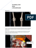 Osteologia Mmii Femur Parte 2 Facundo Patronelli