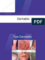 Dermatitis