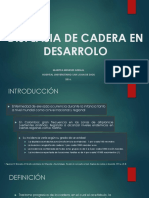 Displasia de Cadera en Desarrolo