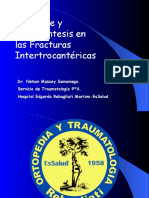 Abordaje y Osteosintesis de Fracturas Intertrocantereas - Dr. Massey