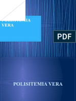 Polisitemia Vera-Nadia