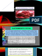 Sufrimiento Fetal