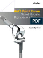 GMRS Distal Femur: Global Modular Replacement System