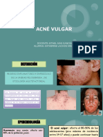 Acne Vulgar