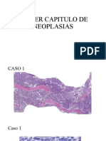 Taller Capitulo de Neoplasias