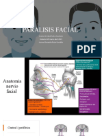 Paralisis Facial y Neuralgia Del V