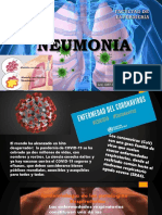 Neumonia-2020