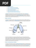 Lobectomy