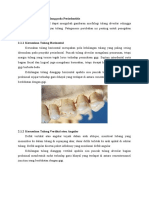 Pola Kerusakan Tulang Periodontitis