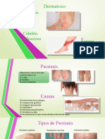 psoriasis y celulitis