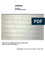 Wellen Syndrome