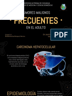 Hepatocarcinoma