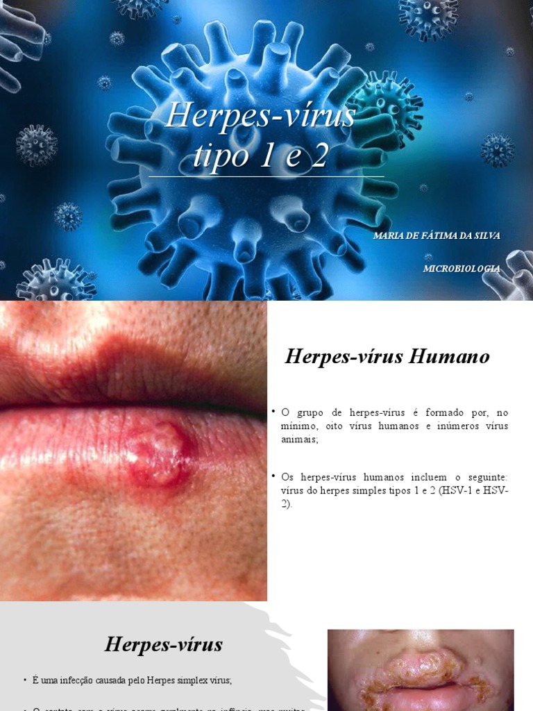 Herpes Vírus | PDF | Herpes simples | Vírus