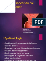 Cancer Du Col