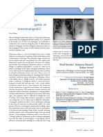 Pulmonary Edema - Cardiogenic or Non-Cardiogenic