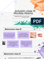 Maloclusion Clase III Mordida Abierta