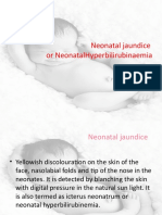 Neonatal Jaundice or Neonatalhyperbilirubinaemia