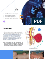 Equipo 4 Meningocele